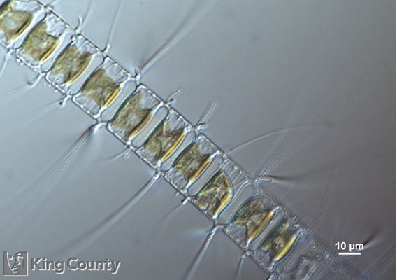 Photo of Chaetoceros diadema